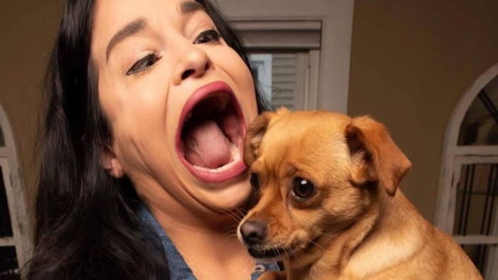 Kisah Wanita Cetak Rekor Mulut Terbesar di Dunia, Dikira Pakai Filter Medsos