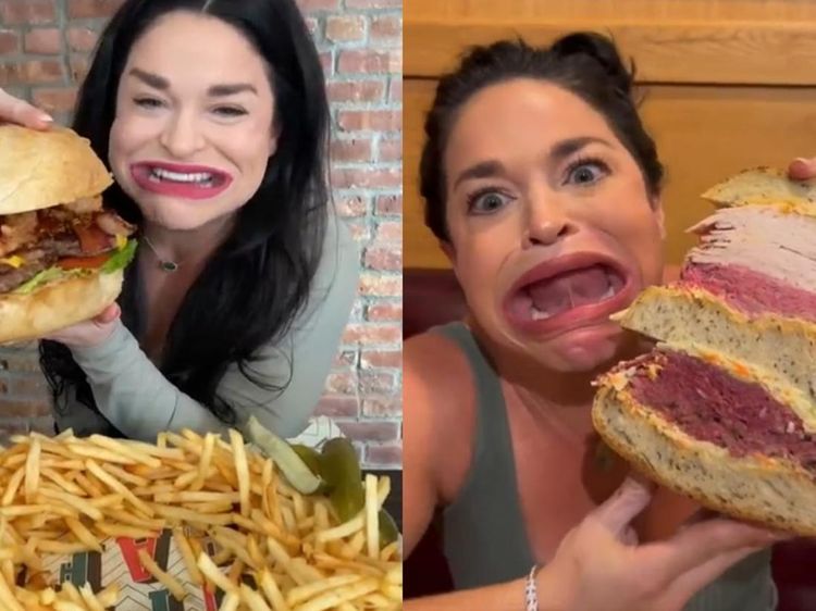 Potret Wanita dengan Mulut Terbesar di Dunia, Bisa Menganga 6,5 Cm