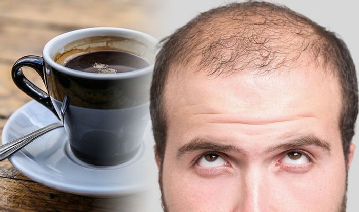 Benarkah Kebiasaan Ngopi Bisa Bikin Rambut Rontok? Ini Penjelasannya