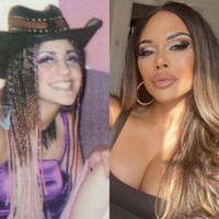 Nasrin sengaja ‘merusak’ wajahnya sendiri dengan operasi plastik. Langkah ekstrem itu dilakukan demi mendapatkan bentuk mata ‘cat eye’ atau ‘mata kucing’. Foto: Instagram/@aesthetic_clinic_london