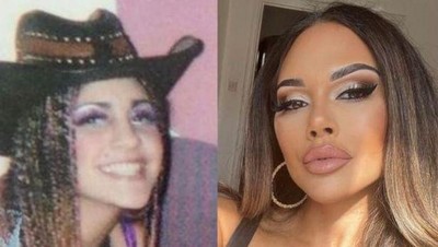 Foto Transformasi Wanita yang Merusak Wajah Demi Punya Mata Cat Eye