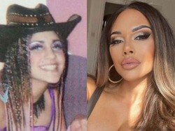 Foto Transformasi Wanita yang Merusak Wajah Demi Punya Mata Cat Eye