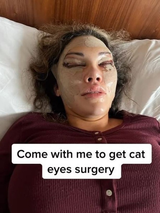 Pemilik klinik kecantikan bernama Aesthetic Clinic ini membagikan proses operasi plastik yang membuat netizen ngeri. Foto: Instagram/@aesthetic_clinic_london