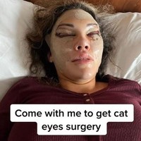 Pemilik klinik kecantikan bernama Aesthetic Clinic ini membagikan proses operasi plastik yang membuat netizen ngeri. Foto: Instagram/@aesthetic_clinic_london