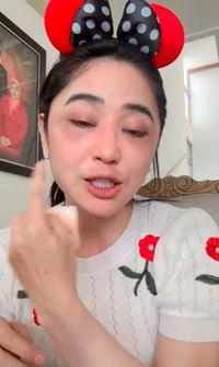 Dewi Perssik Pamer Wajah Tanpa Makeup, Bekas Operasi Bawah Matanya Terlihat