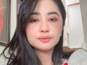 Dewi Perssik Pamer Wajah Tanpa Makeup, Bekas Operasi Bawah Matanya Terlihat