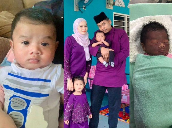 Foto keluarga Farah Adibah Amira Kunyee yang menceritakan kondisi anaknya yang baru lahir