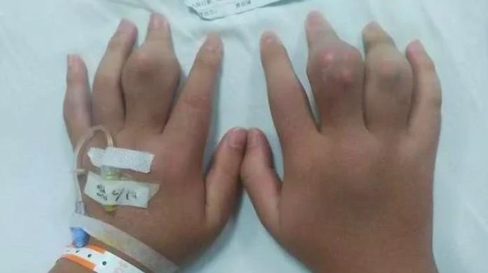 5 Orang Ini Hobi Minum Bubble Tea Berlebihan, Ada yang Koma hingga Lumpuh