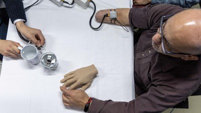 Teknologi Bionik Bantu Orang yang Diamputasi Kembali Rasakan Suhu Benda