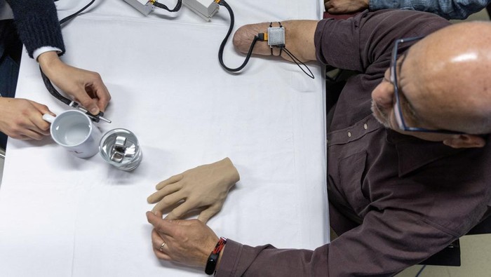 Fabrizio Fidati, who lost his right hand in an accident 25 years ago, points on a rubber hand where he feels on his fantom hand the pen that Francesco Iberite, neural engineer at the Scuola Superiore Sant'Anna (SSSA), applies on his limb  during the presentation of bionic technology that helps amputees feel the temperature of objects again in their phantom hands at the Campus Biotech at the Swiss Federal Institute of Technology (EPFL) in Geneva, Switzerland April 19 , 2023. REUTERS/Denis Balibouse