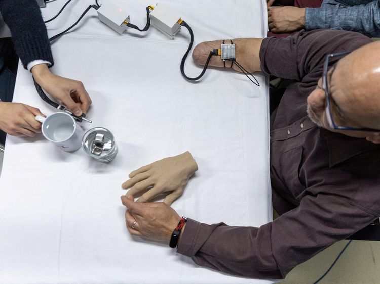 Teknologi Bionik Bantu Orang yang Diamputasi Kembali Rasakan Suhu Benda