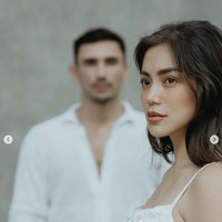 Unggahan tersebut pun banyak mendapat komentar dari para netizen. Tak sedikit yang justru salfok dengan hidung baru Jessica setelah operasi plastik rongga hidung. Foto: Instagram/@inijedar