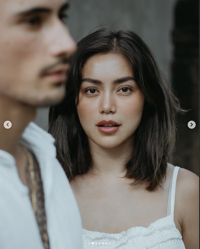 Jessica Iskandar sendiri sebelumnya memang mengaku telah menjalani operasi plastik guna memperbaiki rongga hidungnya yang bengkok. Operasi plastik tersebut dilakukannya di Korea. Foto: Instagram/@inijedar