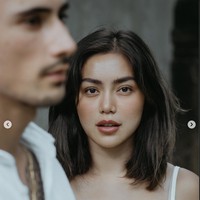 Jessica Iskandar sendiri sebelumnya memang mengaku telah menjalani operasi plastik guna memperbaiki rongga hidungnya yang bengkok. Operasi plastik tersebut dilakukannya di Korea. Foto: Instagram/@inijedar