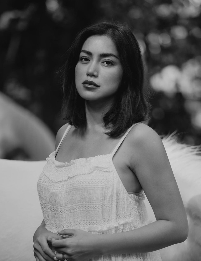 Setelah operasi, hidung baru Jessica sempat ditutupinya. Namun kini hidungnya itu sudah tak lagi ditutupi. Jessica pun tampak bangga memamerkan hidung barunya. Foto: Instagram/@inijedar