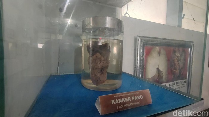 Museum Kanker Indonesia berada di Jalan Kayoon 16-18 Surabaya. Ini merupakan museum kanker pertama dan satu-satunya di dunia.