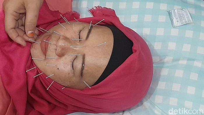 RUU Kesehatan Dinilai Tak Akomodir Pelaku Penyehat Alternatif. (Nizar Aldi/detikSumut)