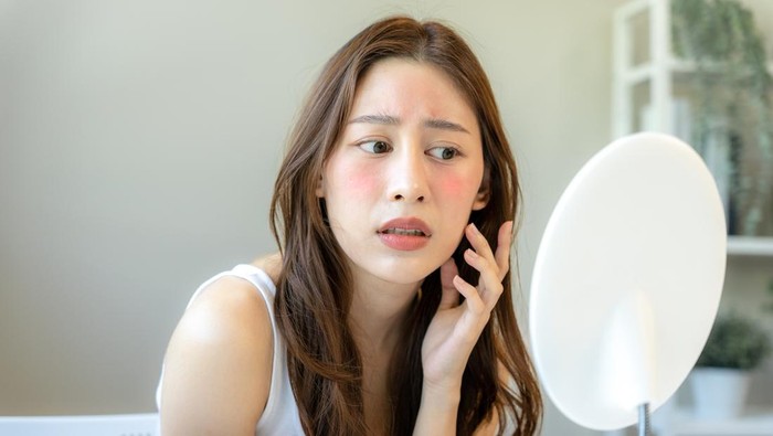 Beautiful Asian women are worried about faces allergic to chemicals in cosmetics. red face from sunburn, sensitive skin, allergic to steroids