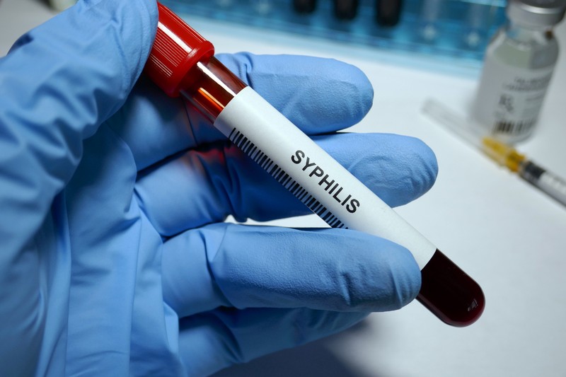 Syphilis - sexually transmitted disease blood test and treatment