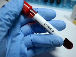 9 Eksperimen Medis Paling Horor, Bikin Merinding