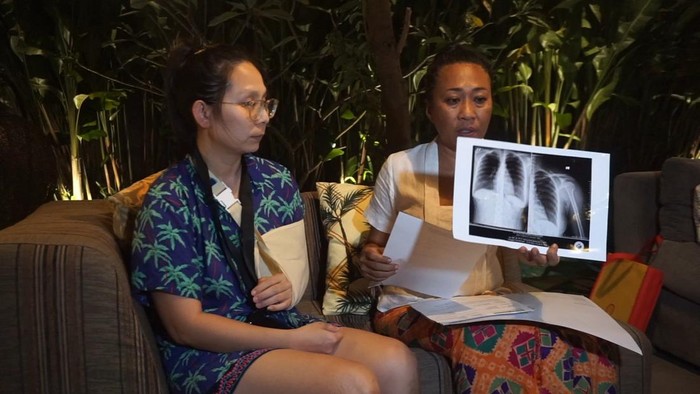 Erti Natalia (kiri) yang terlibat keributan dengan bule Rusia di McD Jimbaran bertemu Niluh Djelantik dan menunjukkan hasil CT scan tulang bahu, Kamis (25/5/2023) malam.