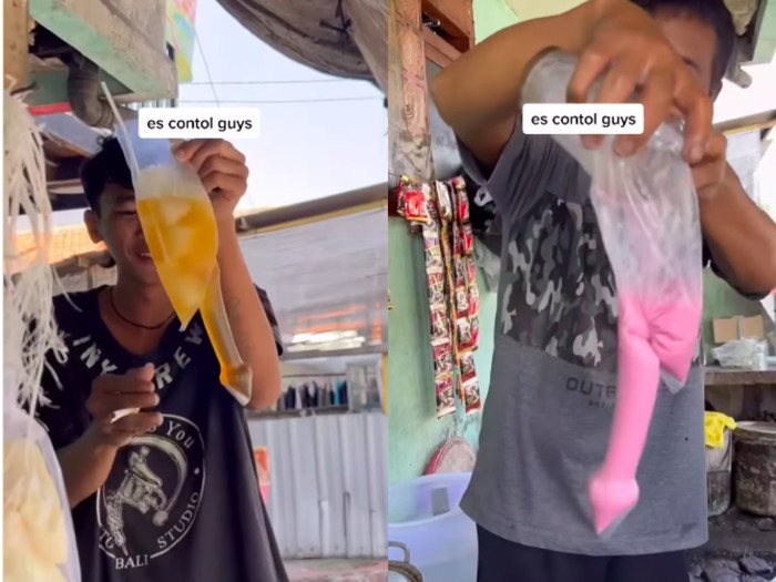 Es kontol