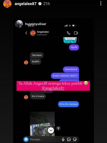 Angela Lee kecelakaan