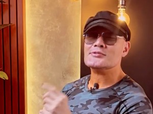 Kata Ahli soal Dagu Deddy Corbuzier yang Berubah Usai Stem Cell