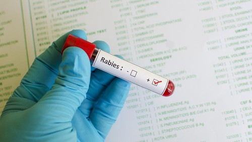 7 Gejala Rabies pada Anak yang Perlu Diwaspadai di Tahap Awal