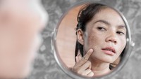 Sering Dikira Bercak Biasa, Ini Cara Bedakan Flek Hitam VS Gejala Kanker Kulit