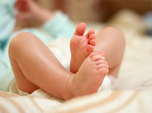 Ternyata Ini Penyebab Bayi di Lombok Terlihat Lahir dengan 6 Kaki