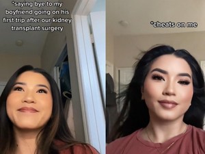 Diselingkuhi usai Donor, Wanita Ini Ceritakan Rasanya Hidup dengan Satu Ginjal