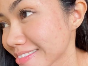 Gaya Yura Yunita Percaya Diri Pamer Wajah Berjerawat dan Ketiak Tak Mulus