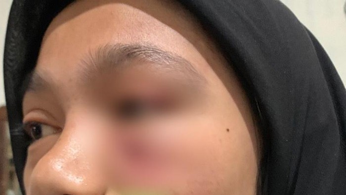Mahasiswi UHO Kendari dianiaya senior wanita.