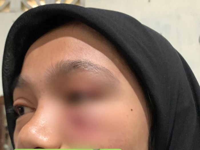 Mahasiswi UHO Kendari dianiaya senior wanita.