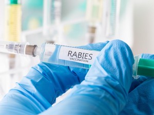 Berapa Lama Gejala Rabies Muncul Setelah Digigit Anjing?