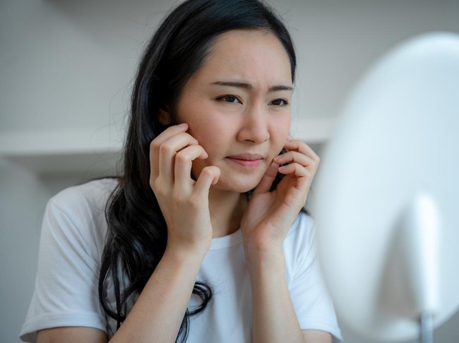 Young woman asian worried about faces Dermatology and allergic to steroids in cosmetics. sensitive skin, red face from sunburn, acne, allergic chemicals, rash face, dermatitis. skin problems beauty