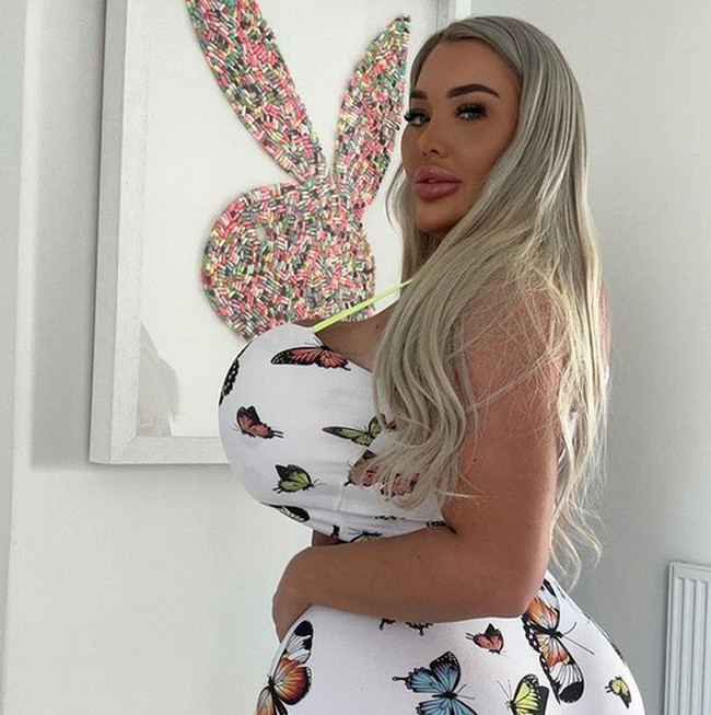 Payudara tak wajarnya itu hasil dari operasi plastik sebanyak lima kali. Kini dadanya berukuran 36NN. Foto: dok. Instagram/@ambermayy_2