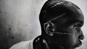 Diambil oleh James Natcheway. Gambar ini menceritakan genosida yang terjadi di rwanda. Pria Hutu ini berada di salah satu kamp konsentrasi yang disiksa secara brutal. Dia kemudian berhasil bertahan setelah dibebaskan. Foto: via 121Cliks