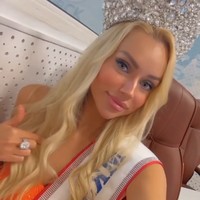 Setelah kontroversinya, Natalya baru-baru ini mengunggah potret terbarunya. Ia tak ragu menampilkan wajahnya dalam unggahan video Insta Story seolah ingin menunjukkan bahwa penampilannya asli.Foto: Instagram