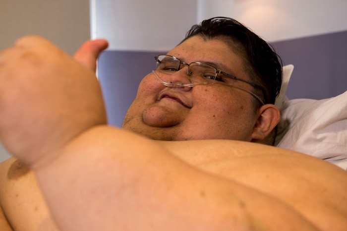 Mexican 32-year-old Juan Pedro Franco, who weighs almost 500 kilograms (1100 pounds) arrives at the hospital in Guadalajara, Mexico on May 05, 2017.
Franco who used to be the most obese man in the world, four months ago underwent a treatment and managed to lose 170 kg. On a second stage he undergoes a surgery on May 09, 2017.   / AFP PHOTO / Hector Guerrero        (Photo credit should read HECTOR GUERRERO/AFP via Getty Images)