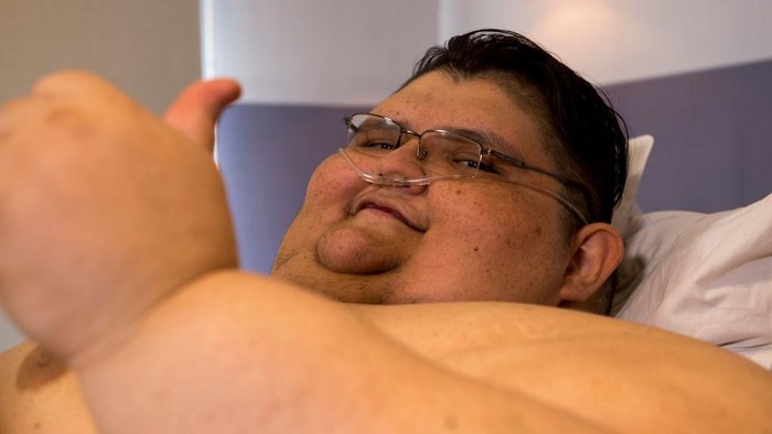 Derita Pria Berbobot 600 Kg hingga Nyaris Meninggal