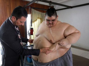 Pria Terberat di Dunia Sampai Operasi Lambung demi Enyahkan Ratusan Kg