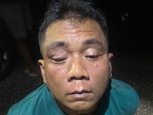 Perampok Truk Modus Kopi Beracun Sudah 2 Kali Beraksi
