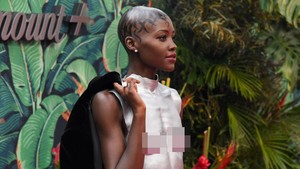 Bintang 12 Years a Slave, Lupita Nyongo, didiagnosis mengidap fibroid rahim atau pertumbuhan non-kanker yang ada di dalam rahimnya. Diagnosa ini baru diketahui pada 2014, di momen tahun yang sama saat ia memenangkan piala Oscar karena film tersebut.  Foto: Getty Images