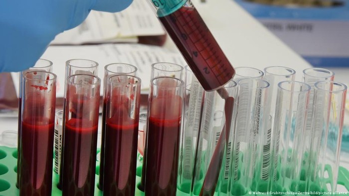 Tes Darah Terbaru Bisa Bantu Deteksi Kanker Sejak Dini
