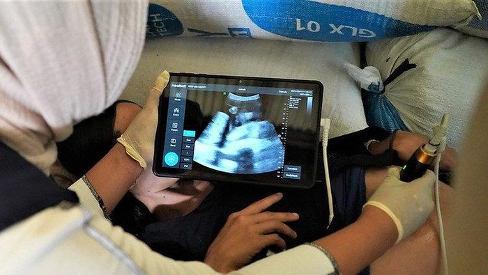 Momen Bumil di Baduy Dalam Mulai Dapat Akses USG di Puskesmas