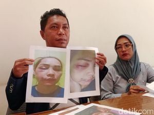 Pilu ASN Istri Polisi di Raja Ampat Babak Belur Dianiaya Suami Sendiri