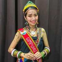Evita Patcey Edgar Delmundo menidap kondisi langka yang dinamakan Giant Congenital Melanocytic Nevus yang menyebabkan tubuhnya ditumbuhi bintik kecil berwarna kehitaman di atas permukaan kulit. Foto: Instagram/@evita_delmundo