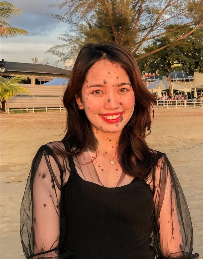 Semasa kecil Evita mengaku selalu merasa kesepian karena tidak ada yang ingin berteman dengannya. Padahal kondisinya itu bukanlah penyakit dan tidak menular.  Foto: Instagram/@evita_delmundo